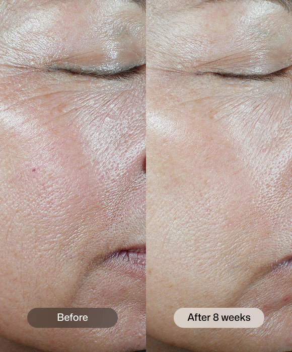 C+ Correcting Complex 30%® - Image 5